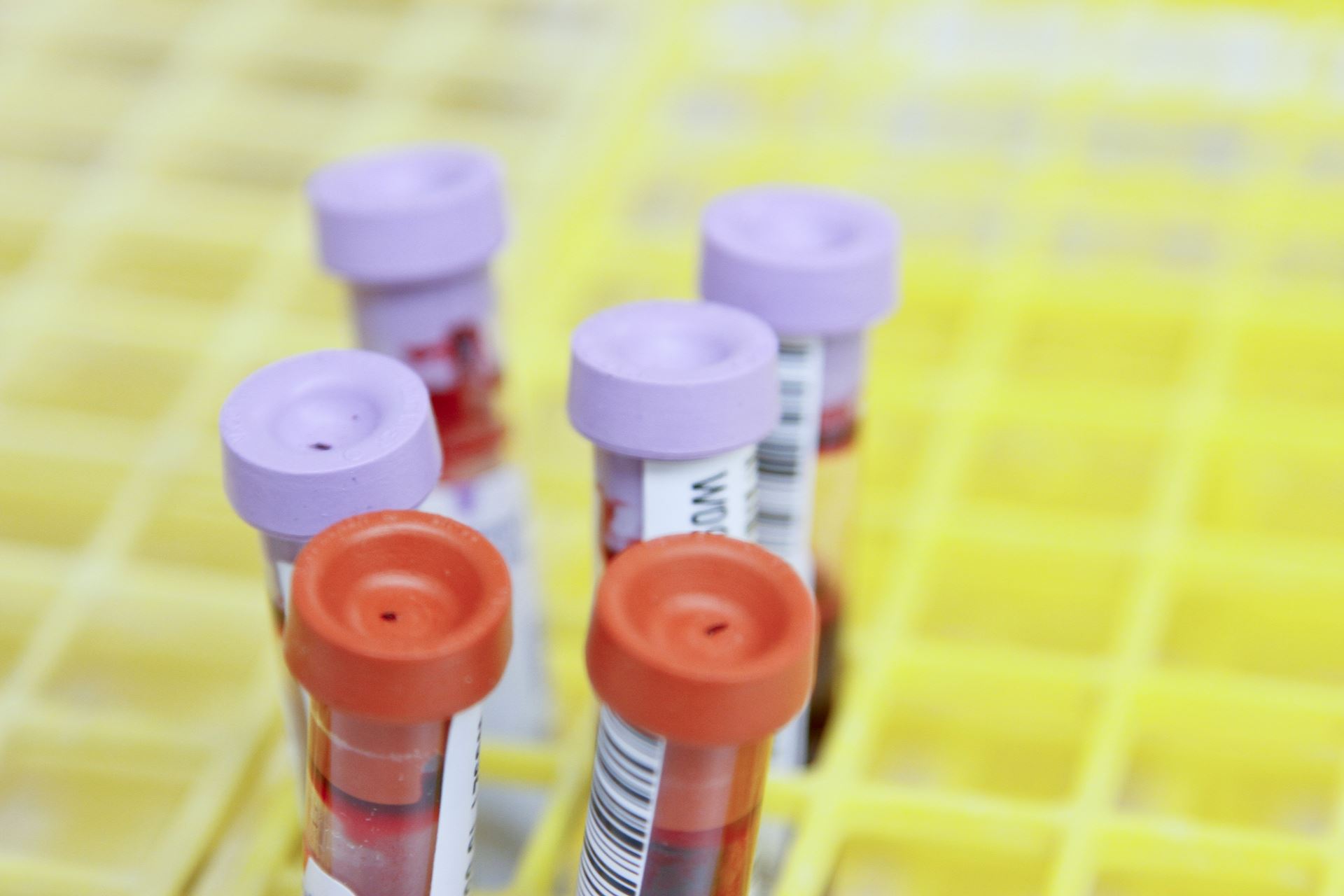 PSA blood test